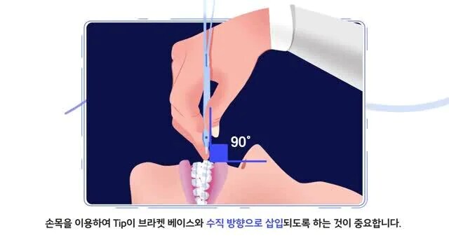 브라켓 사용시 주의사항
