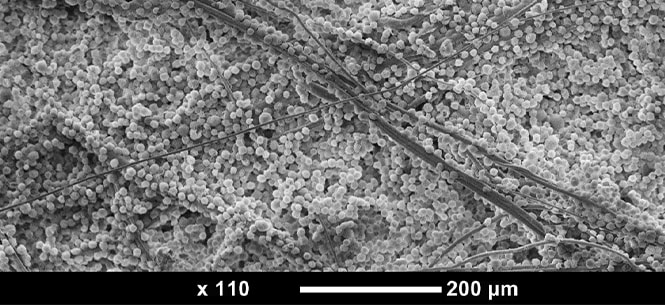 A scanning electron microscopy showing whole cells being adsorbed and captured on the nonwoven fiber
