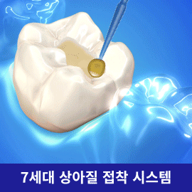 싱글본드 유니버셜 본딩제