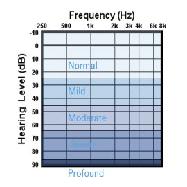 A chart of frequency and frequency levels